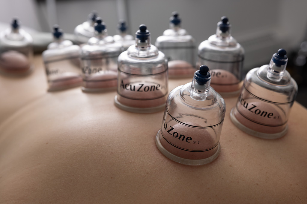 Cupping-Add-Ons